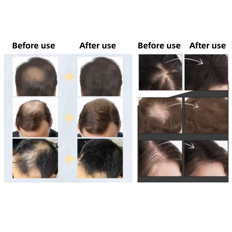 20pcsHair Fiber Keratin Hair B - đánh giá và giá Hair Care Natural Products