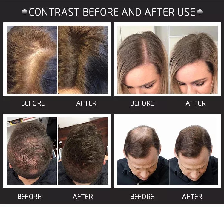 28g Hair Building Fibers Come  - đánh giá và giá Hair Care Natural Products