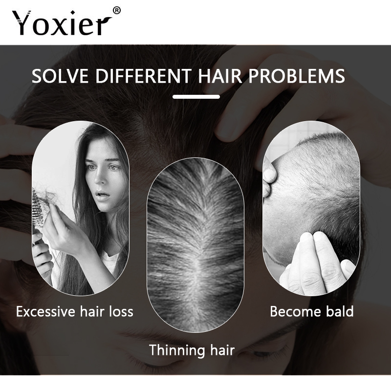 Chuyên Sâu Serum Kích Kem Ngăn - đánh giá và giá Hair Care Hair Serum
