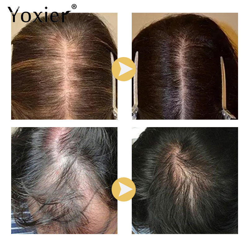 Chuyên Sâu Serum Kích Kem Ngăn - đánh giá và giá Hair Care Hair Serum