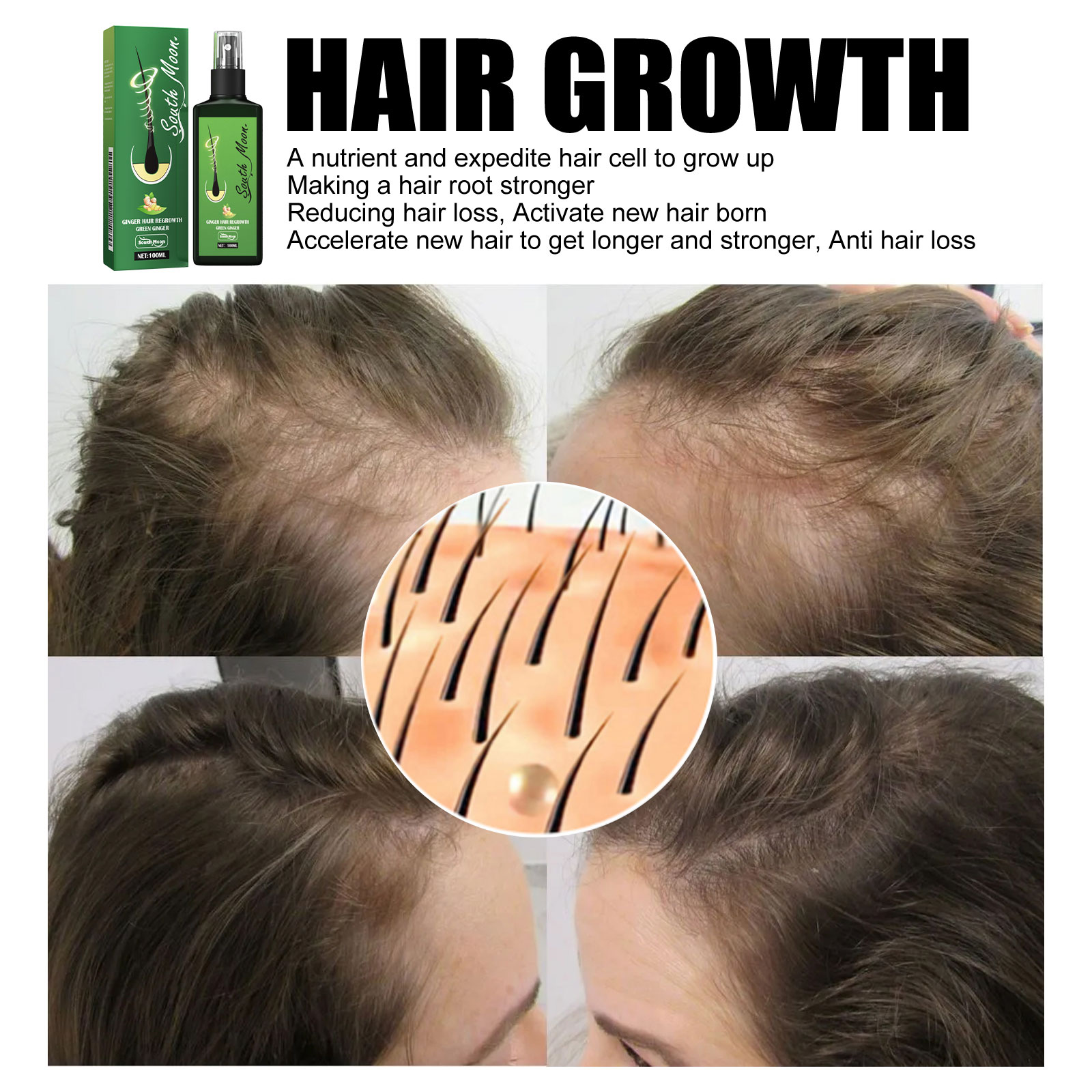 Ginger Hair Density Serum Spra - đánh giá và giá Hair Care Near Me