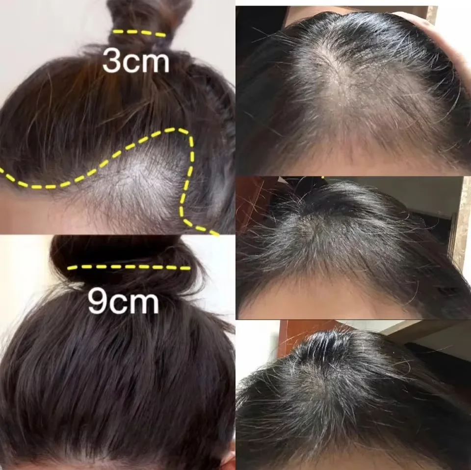 Fast Ginger Hair Growth Cream  - đánh giá và giá Hair Care Near Me