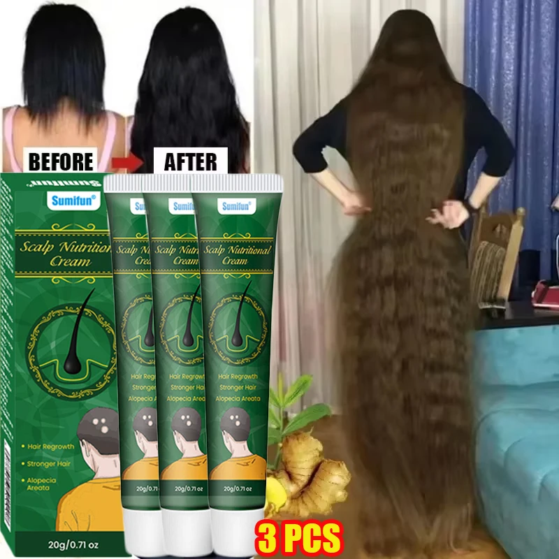 Fast Ginger Hair Growth Cream  - đánh giá và giá Hair Care Near Me