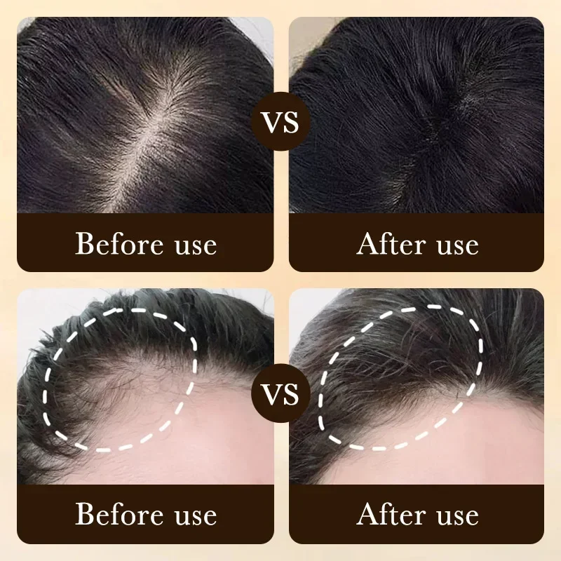 Biotin Fast Hair Growth Oil Pr - đánh giá và giá Hair Care Near Me