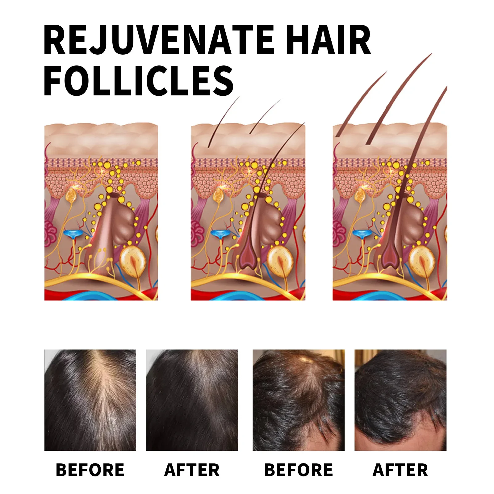 Ginger Hair Growth Products Fa - đánh giá và giá Hair Care Natural Products